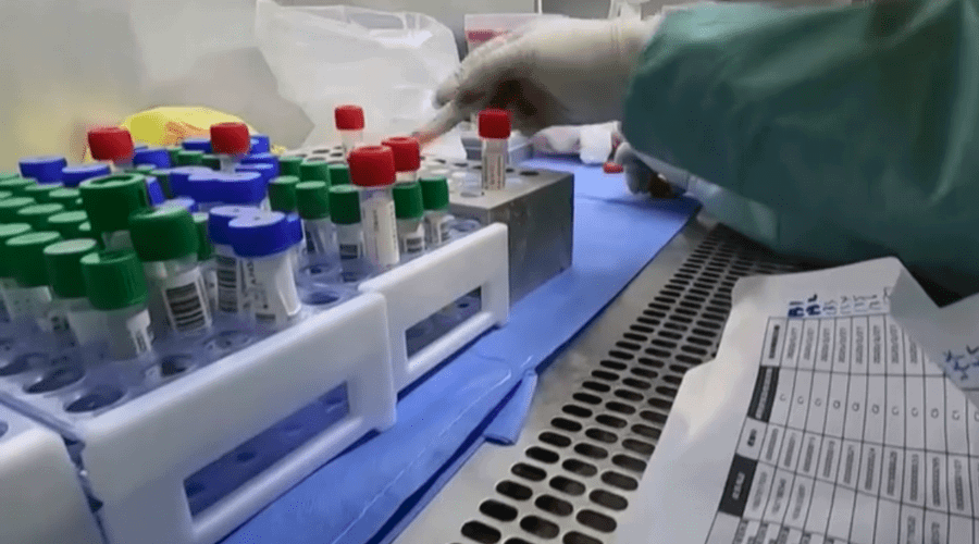 Leopoldina registra novo óbito por Covid e mais 11 casos nas últimas 24 horas