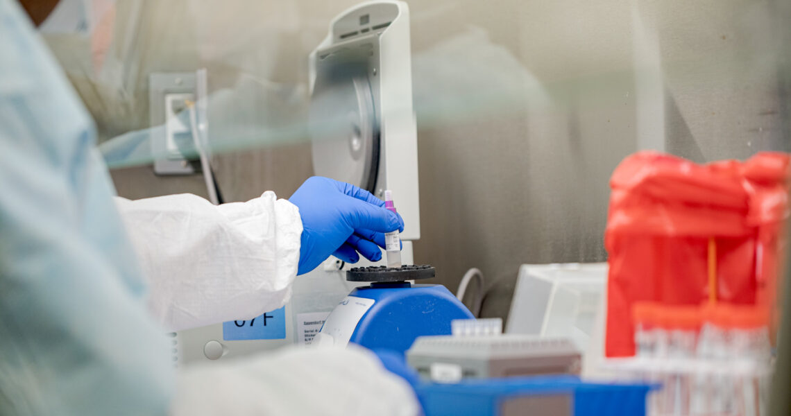 Leopoldina registra nova morte por Covid neste sábado (20)