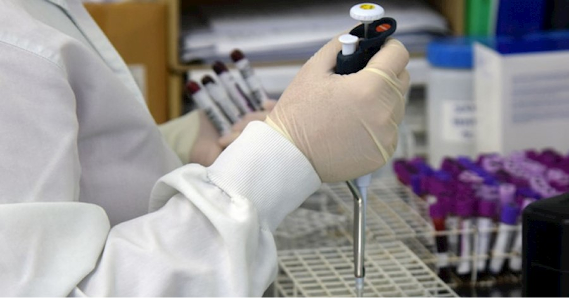 Variante brasileira do coronavírus é identificada em Além Paraíba