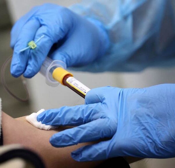 Anticorpos contra a Covid duram até 8 meses nos pacientes, diz estudo