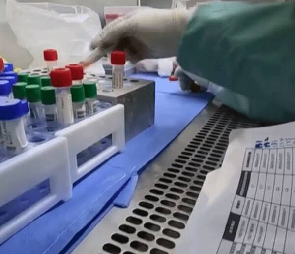 Leopoldina registra novo óbito por Covid e mais 34 casos nas últimas 24 horas