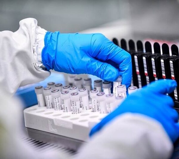 Leopoldina registra dois óbitos e 124 novos casos de Covid nesta segunda