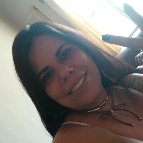 Campanha em Leopoldina pede ajuda para cirurgia em mulher diagnosticada com fibrose