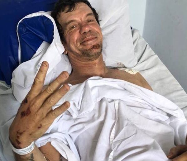 Filha cria vakinha para ajudar na recuperação do pai que sofreu acidente de moto em Leopoldina