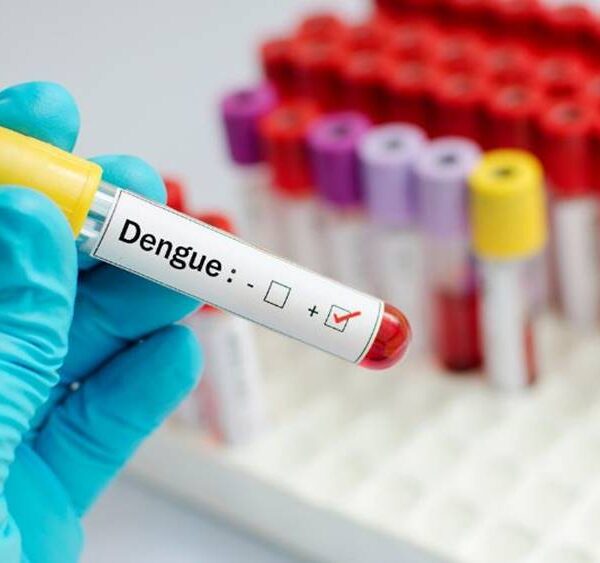 Cataguases decreta estado de emergência em saúde pública por causa da evolução de casos de dengue