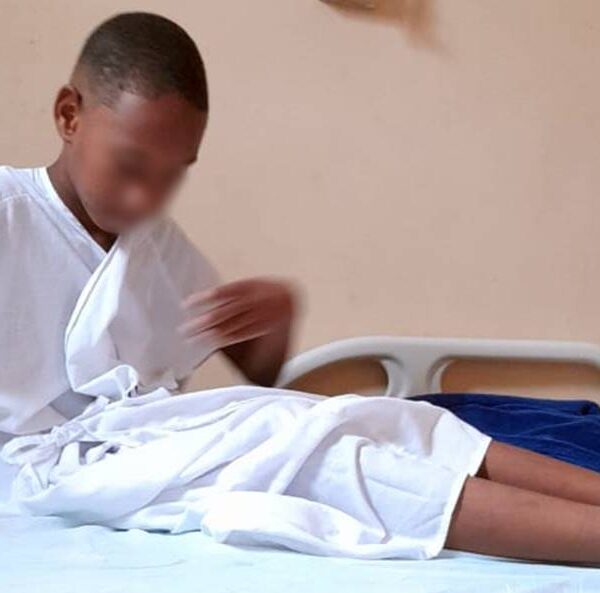 Menino de 10 anos em Leopoldina aguarda há 7 meses por cirurgia para corrigir canal da urina